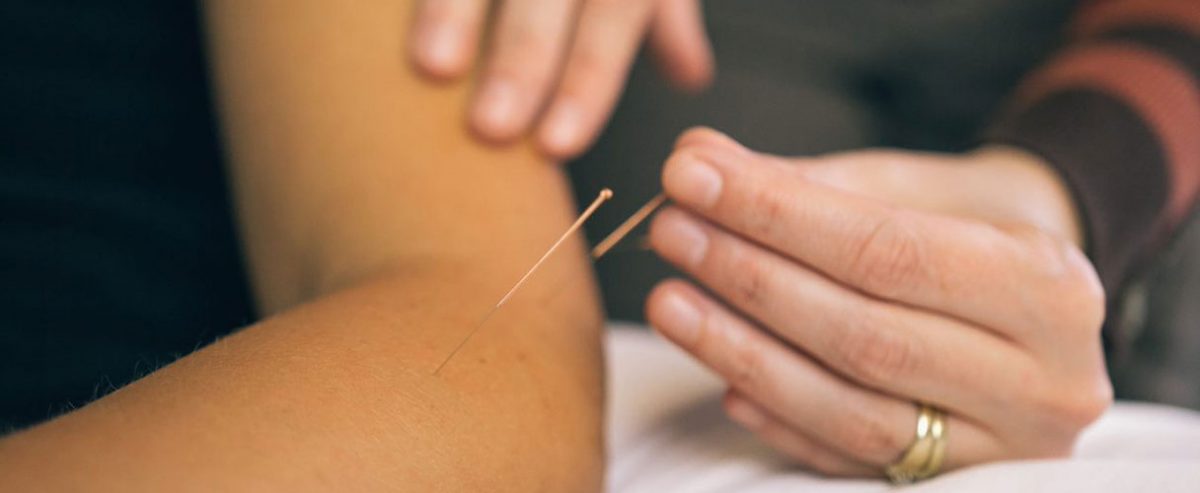 Acupuncture and IMS Therapy | Allied Physiotherapy Health Group